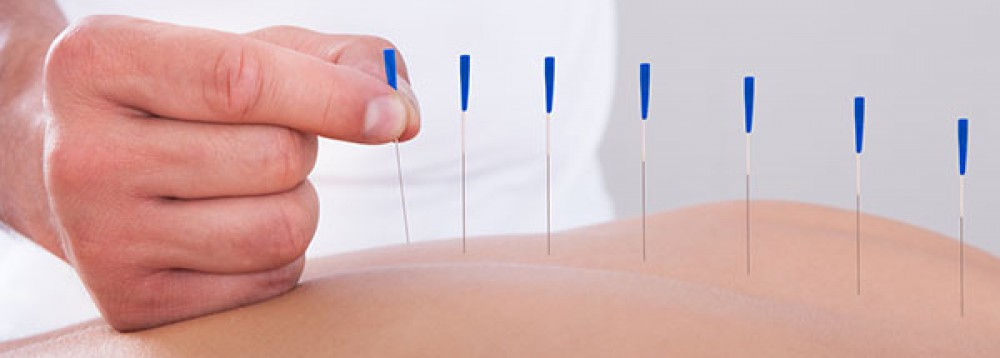 Oriental Acupuncture
